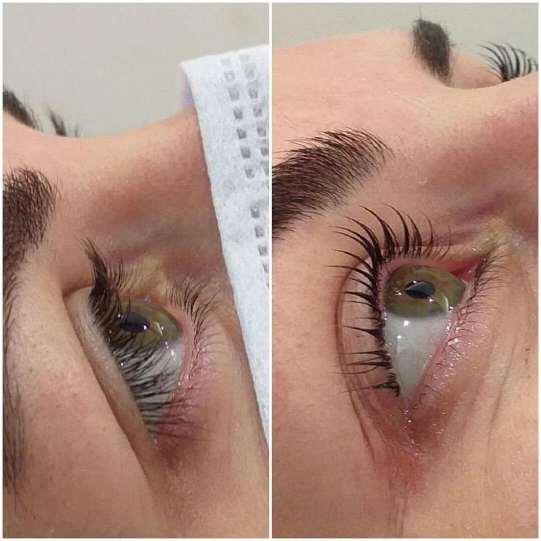 Estemedic Güzellik Merkezi - Tunalı Güzellik Merkezleri - 2. Fotoğraf