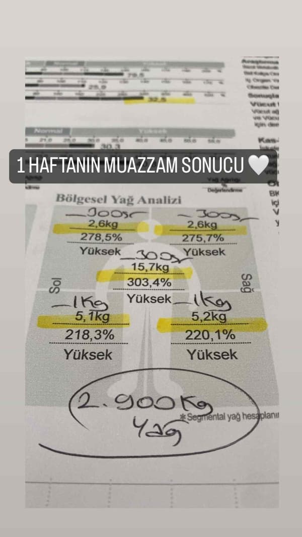 Uzman Diyetisyen Büşra Yılmaz - 26. Fotoğraf