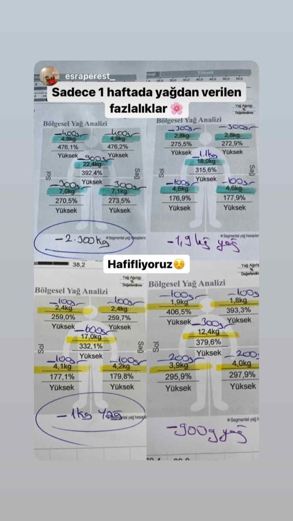 Uzman Diyetisyen Büşra Yılmaz - 25. Fotoğraf Uzman Diyetisyen Büşra Yılmaz - 25. Fotoğraf