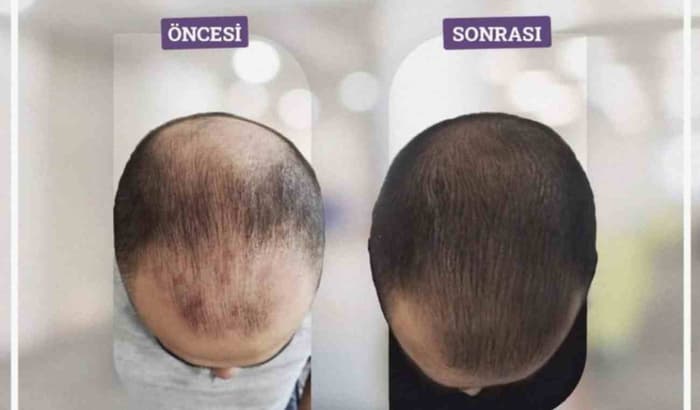 Touch Güzellik Salonu - 5. Fotoğraf