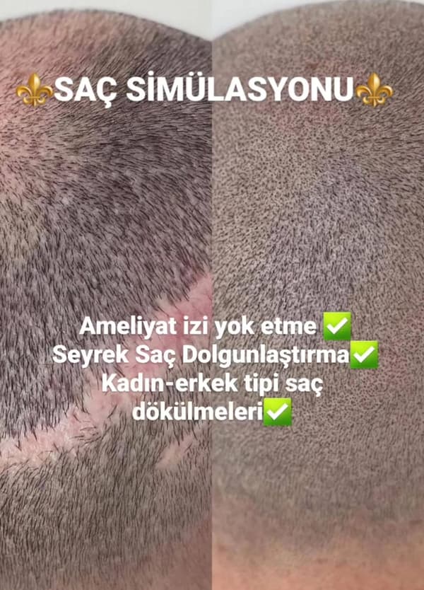 Touch Güzellik Salonu - 45. Fotoğraf