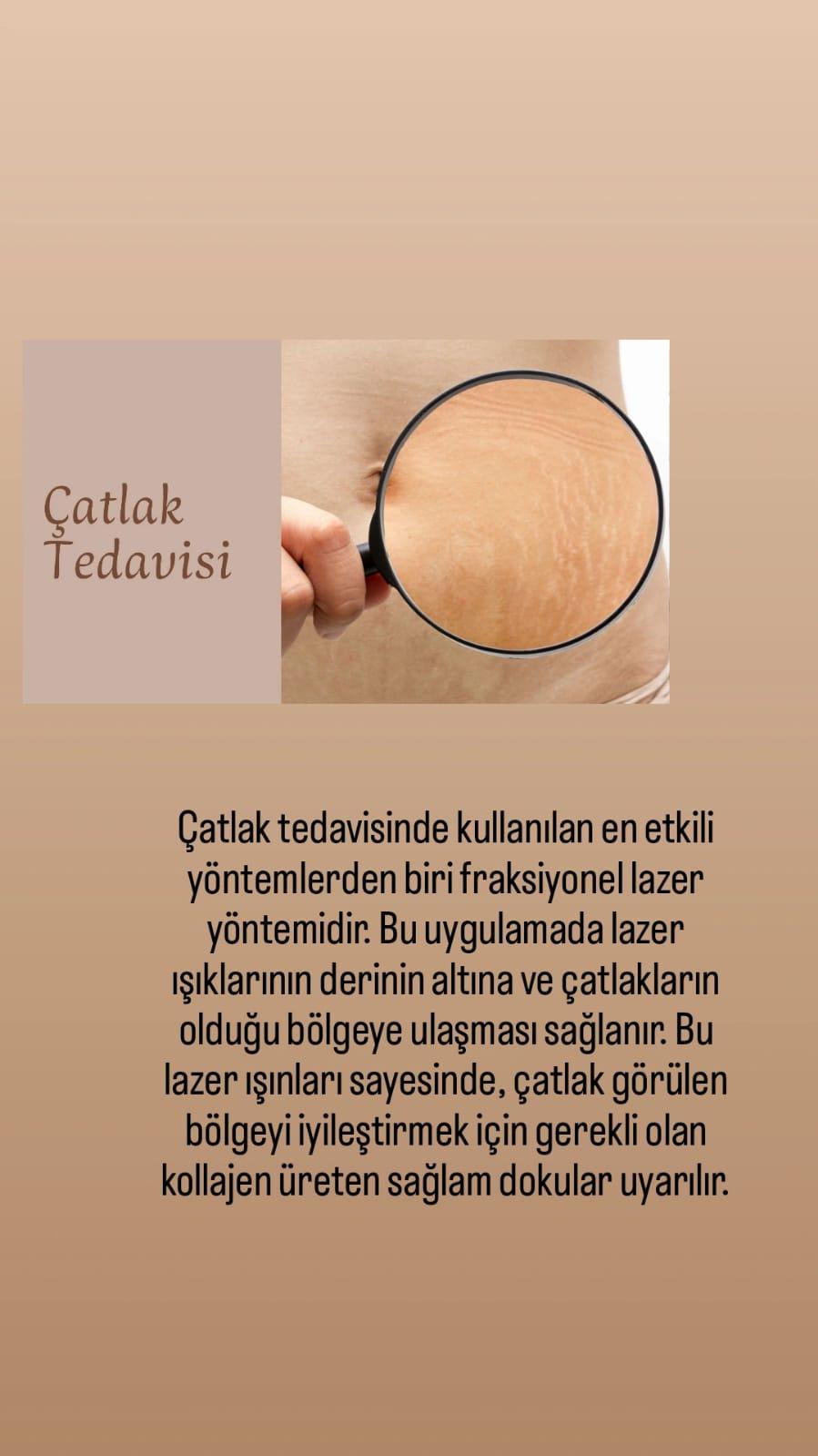 Touch Güzellik Salonu