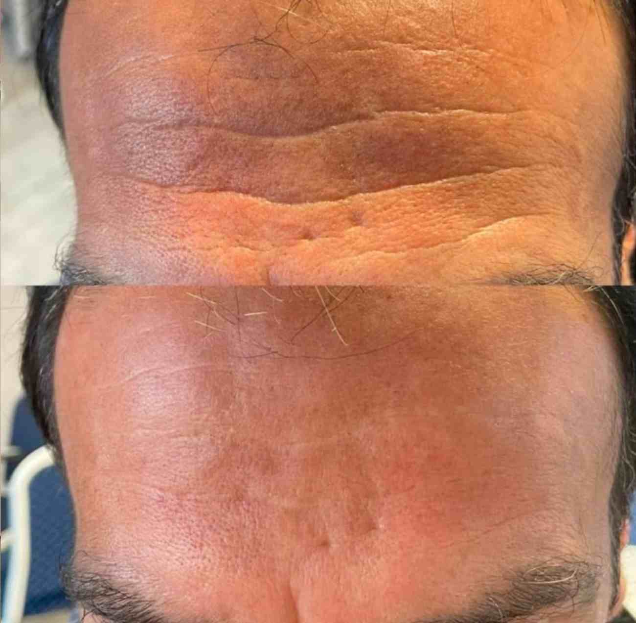 Touch Güzellik Salonu - Ankara Dudak Üstü Bakımı - 3. Fotoğraf