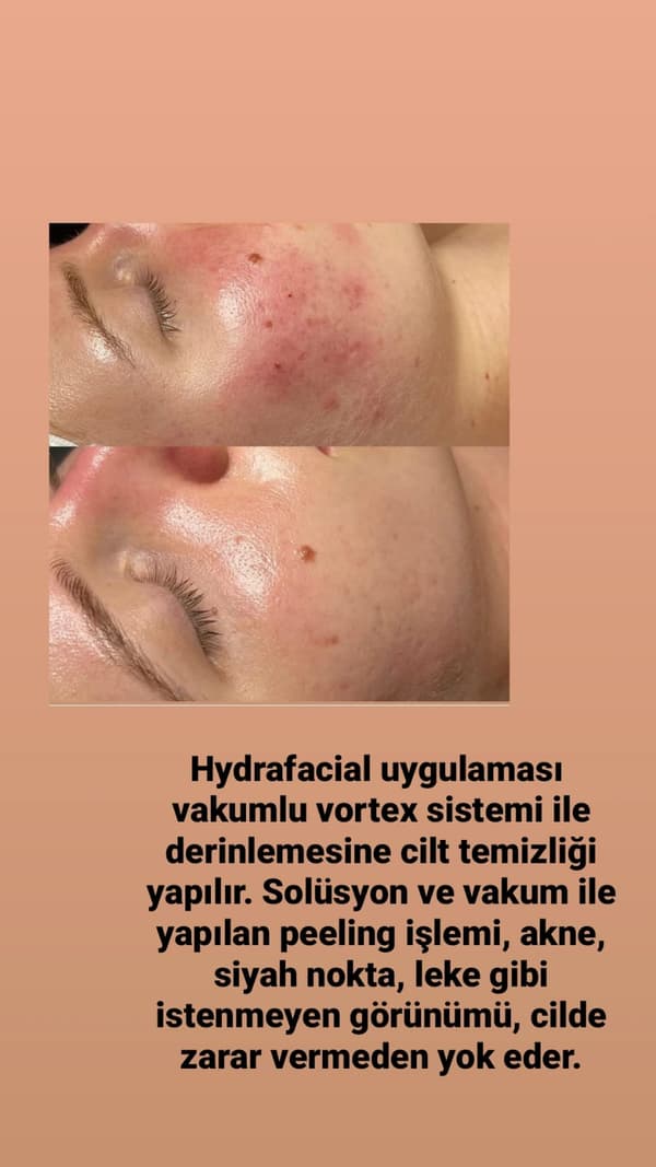 Touch Güzellik Salonu - 43. Fotoğraf