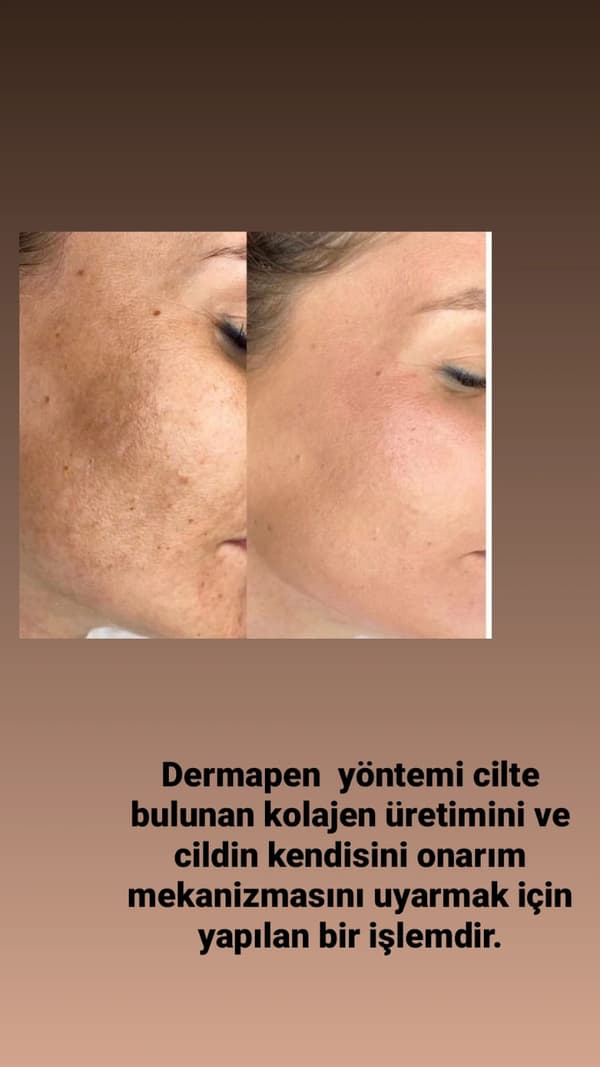 Touch Güzellik Salonu - 41. Fotoğraf