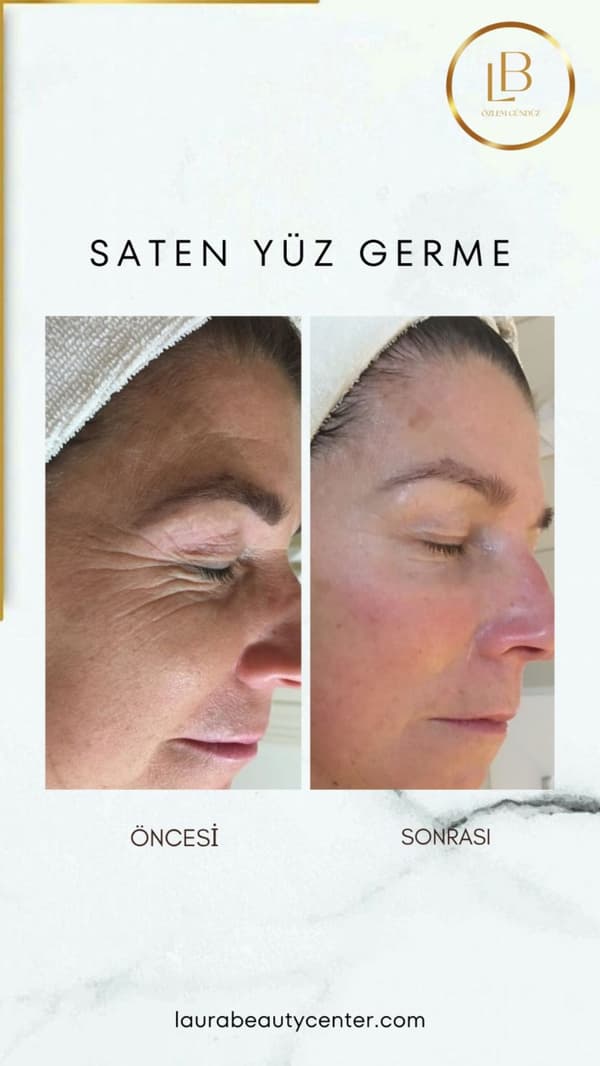 Laura Beauty  - 5. Fotoğraf