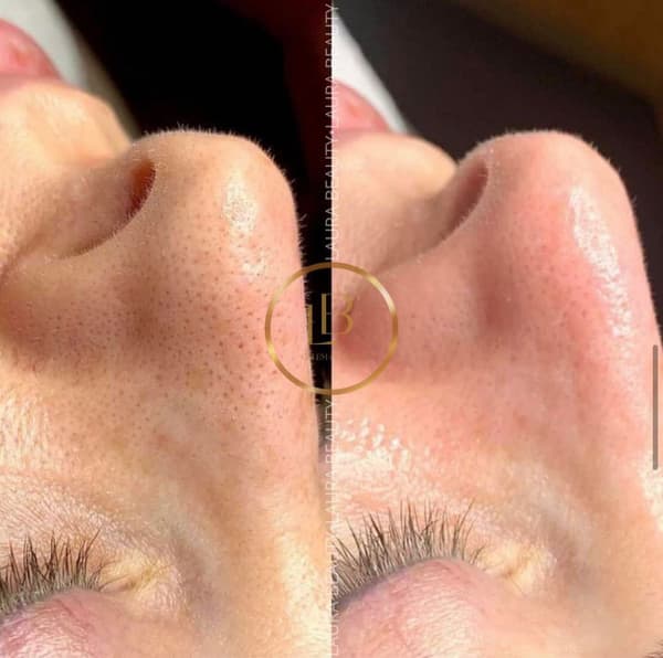 Laura Beauty  - 6. Fotoğraf