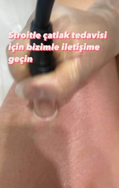 Şule Gürsoy Güzellik Salonu - 22. Fotoğraf