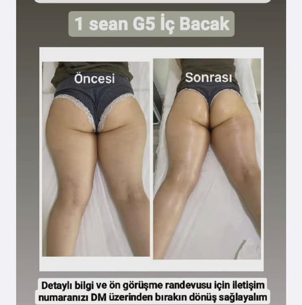 Songül Şahin Güzellik Salonu - 19. Fotoğraf