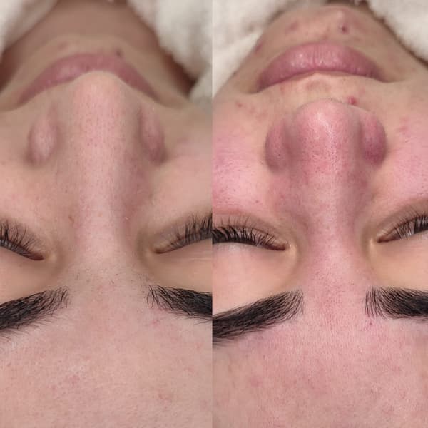 Songül Şahin Güzellik Salonu - 16. Fotoğraf Songül Şahin Güzellik Salonu - 16. Fotoğraf