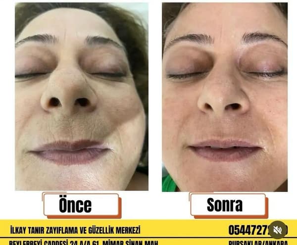 İlkay Tanır Güzellik Salonu - 7. Fotoğraf İlkay Tanır Güzellik Salonu - 7. Fotoğraf