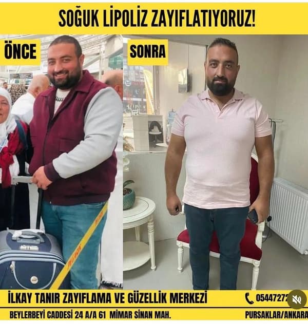 İlkay Tanır Güzellik Salonu - 6. Fotoğraf