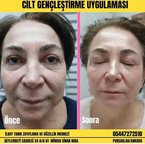 İlkay Tanır Güzellik Salonu - 1. Fotoğraf İlkay Tanır Güzellik Salonu - 1. Fotoğraf
