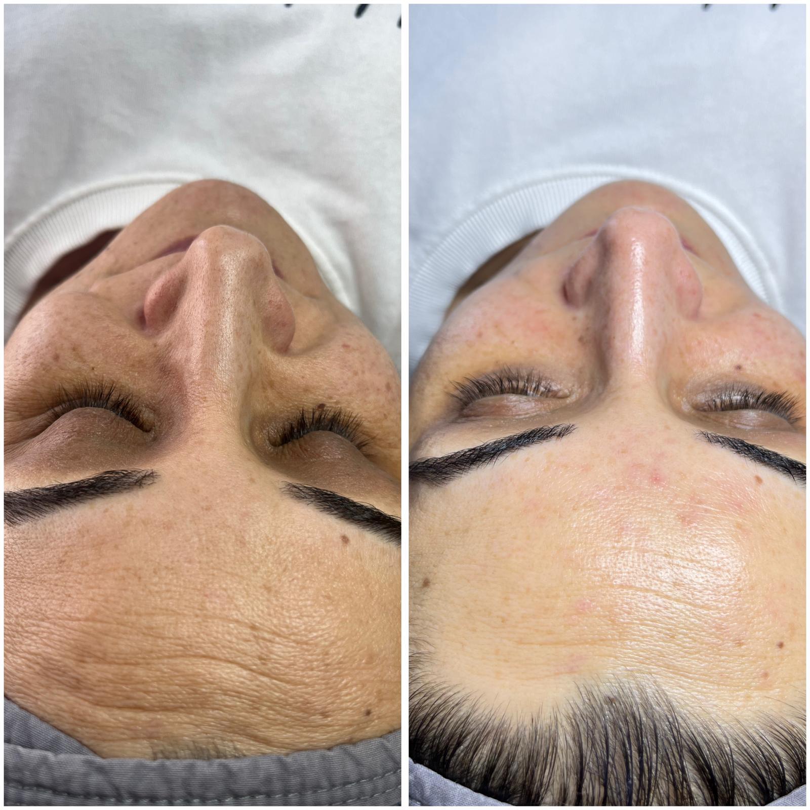 Gülay Koç Güzellik