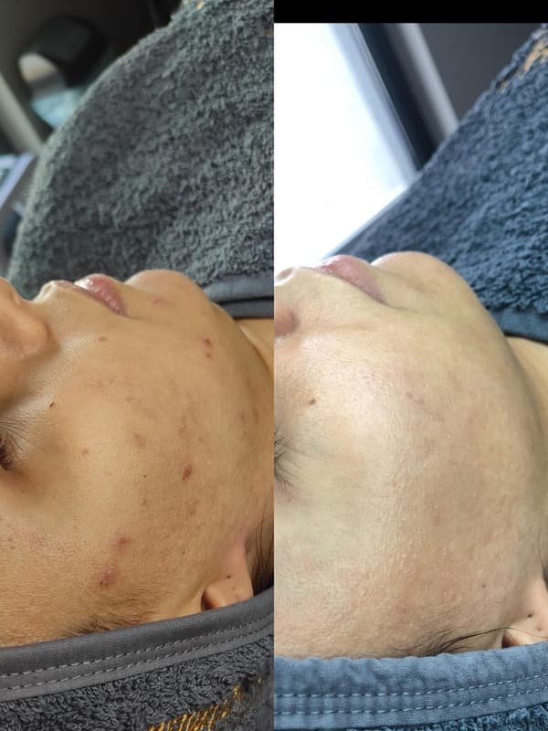 Gülay Koç Güzellik - 4. Fotoğraf Gülay Koç Güzellik - 4. Fotoğraf