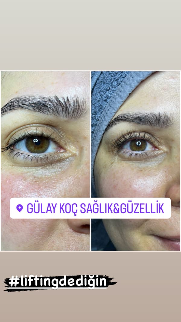 Gülay Koç Güzellik - 5. Fotoğraf Gülay Koç Güzellik - 5. Fotoğraf