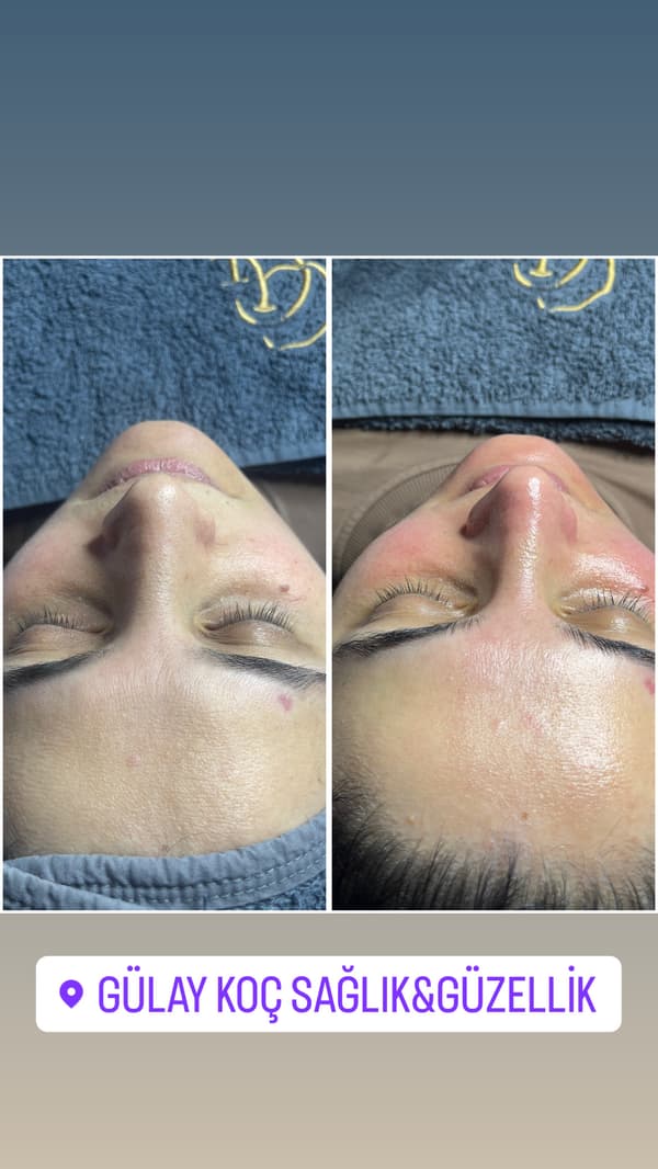 Gülay Koç Güzellik - 8. Fotoğraf Gülay Koç Güzellik - 8. Fotoğraf