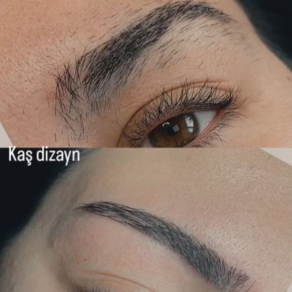 Nergis Epilasyon ve Güzellik - 17. Fotoğraf