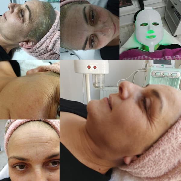 Zeynep Gökgöz Güzellik - 8. Fotoğraf