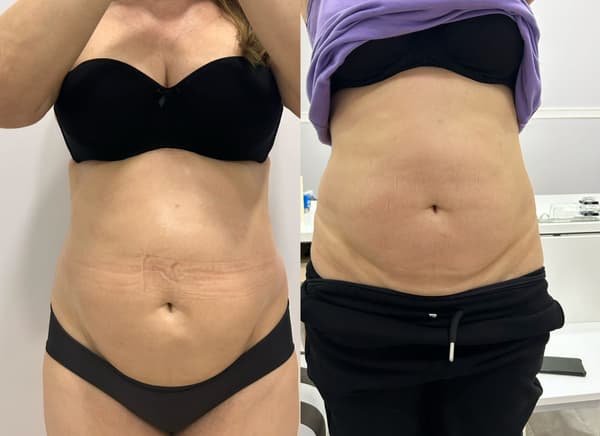 Serra Güzellik - 7. Fotoğraf Serra Güzellik - 7. Fotoğraf