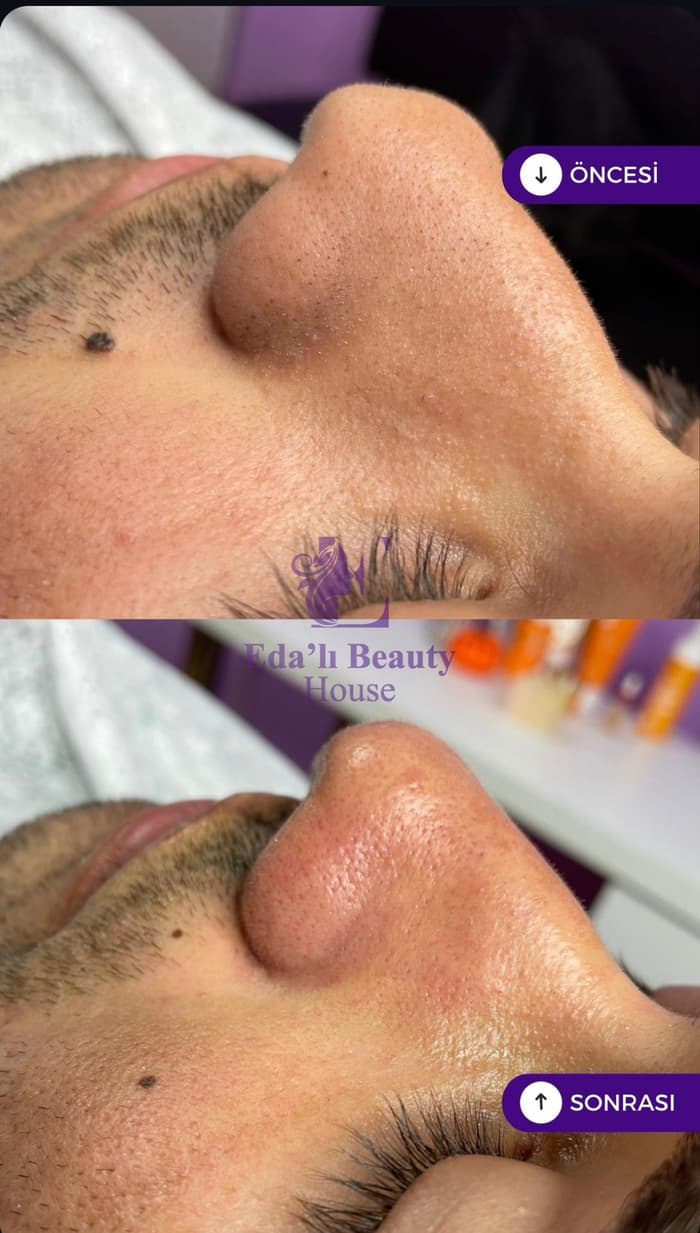 Edalı Beauty House - 5. Fotoğraf