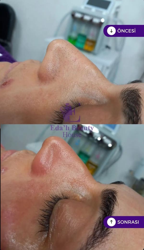 Edalı Beauty House - 6. Fotoğraf