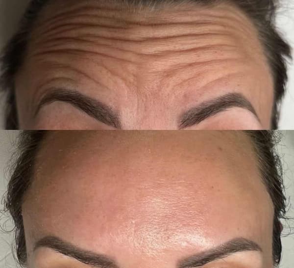 Tuğba Beauty Therapy - 15. Fotoğraf