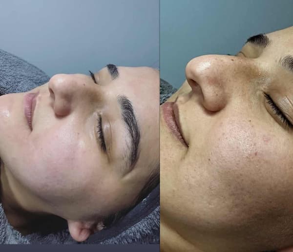 Tuğba Beauty Therapy - 9. Fotoğraf
