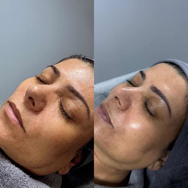 Tuğba Beauty Therapy - 28. Fotoğraf