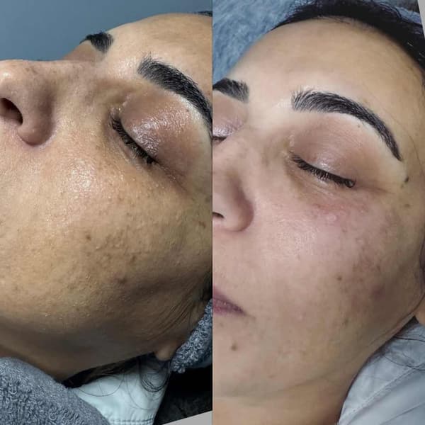 Tuğba Beauty Therapy - 12. Fotoğraf