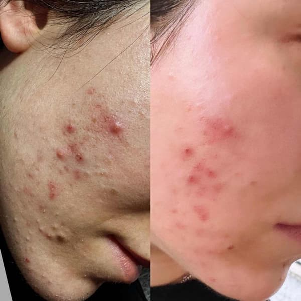 Tuğba Beauty Therapy - 22. Fotoğraf