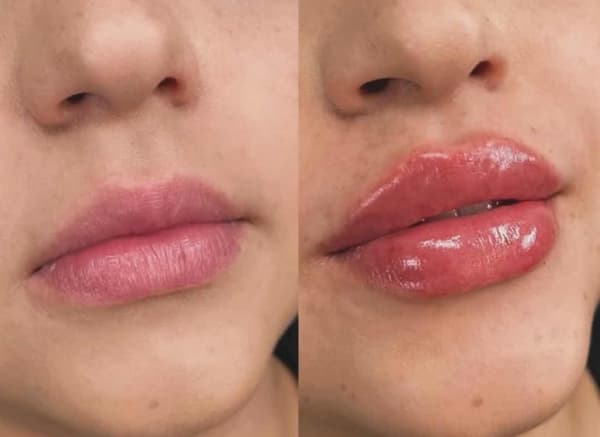 Tuğba Beauty Therapy - 1. Fotoğraf Tuğba Beauty Therapy - 1. Fotoğraf