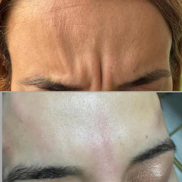 Tuğba Beauty Therapy - 27. Fotoğraf