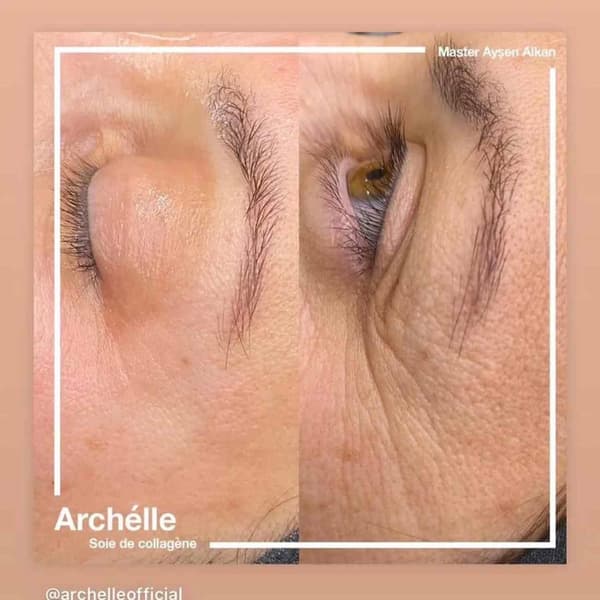 Didem Doğan Beauty - 6. Fotoğraf Didem Doğan Beauty - 6. Fotoğraf