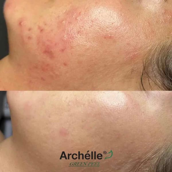 Didem Doğan Beauty - 7. Fotoğraf Didem Doğan Beauty - 7. Fotoğraf