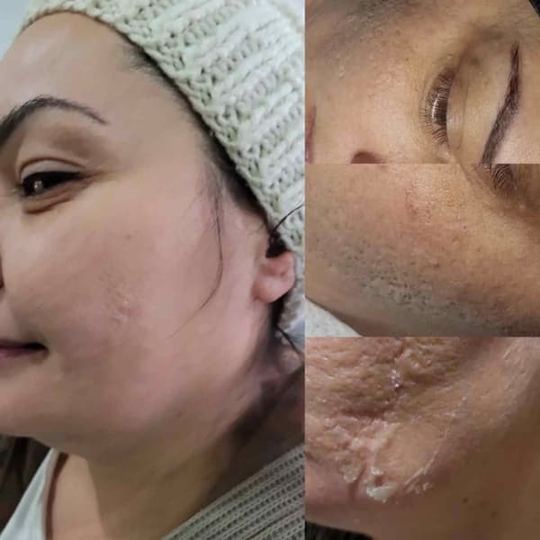 Didem Doğan Beauty - 5. Fotoğraf Didem Doğan Beauty - 5. Fotoğraf