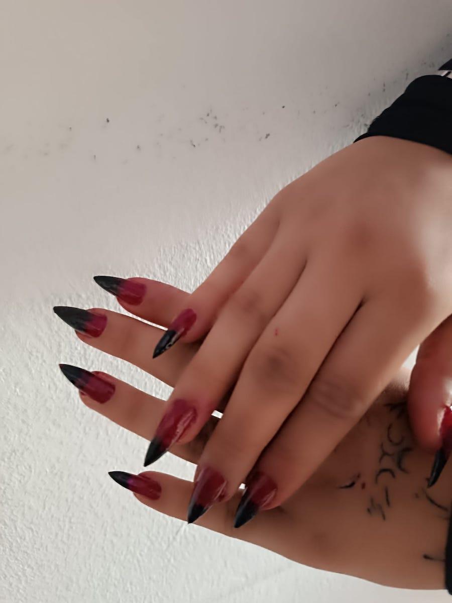 ND Beauty Center - Ankara Dudak Üstü Bakımı - 4. Fotoğraf