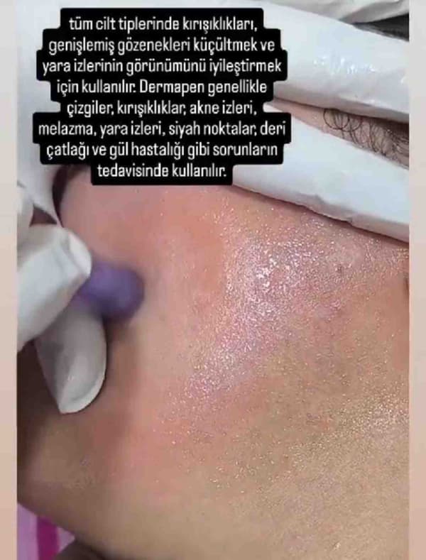 ND Beauty Center - 22. Fotoğraf