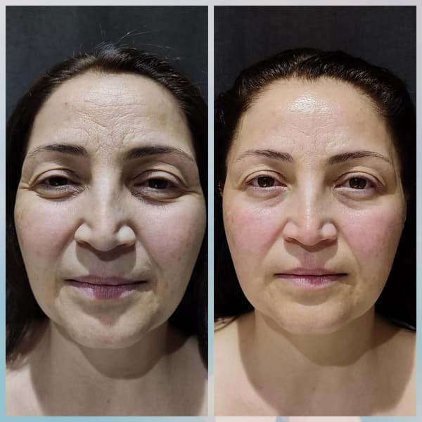 Merve Şensoy Güzellik Merkezi - 2. Fotoğraf Merve Şensoy Güzellik Merkezi - 2. Fotoğraf