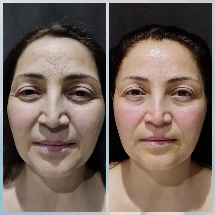 Merve Şensoy Güzellik Merkezi - 2. Fotoğraf
