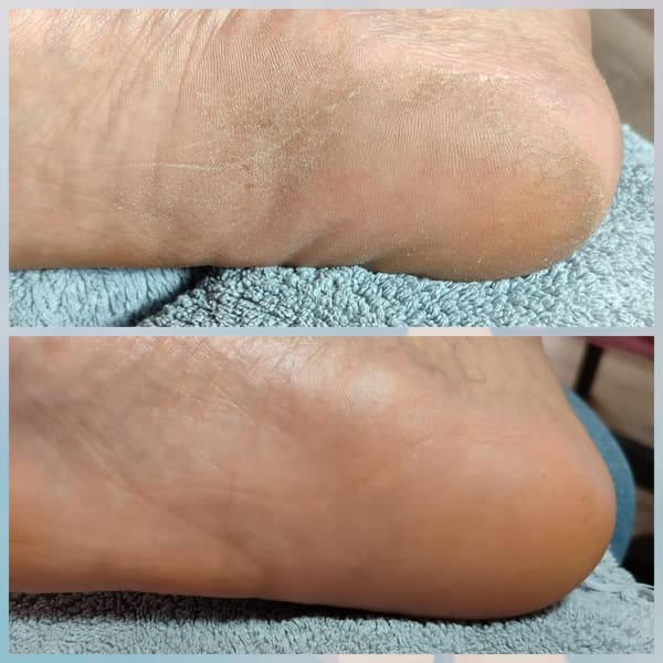 Merve Şensoy Güzellik Merkezi - 29. Fotoğraf Merve Şensoy Güzellik Merkezi - 29. Fotoğraf