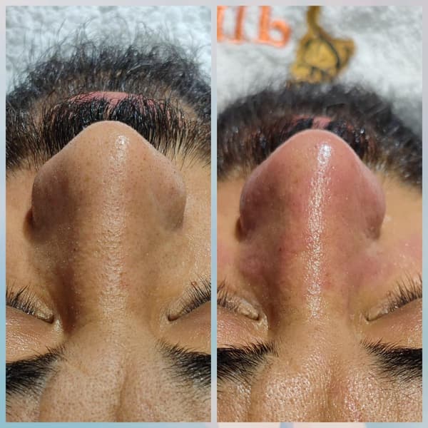 Merve Şensoy Güzellik Merkezi - 13. Fotoğraf Merve Şensoy Güzellik Merkezi - 13. Fotoğraf