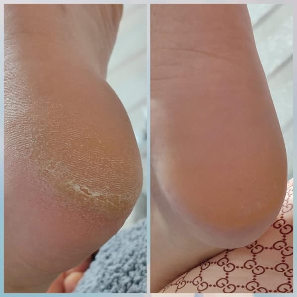 Merve Şensoy Güzellik Merkezi - 11. Fotoğraf Merve Şensoy Güzellik Merkezi - 11. Fotoğraf