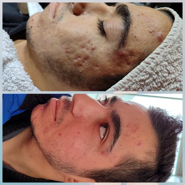 Merve Şensoy Güzellik Merkezi - 28. Fotoğraf Merve Şensoy Güzellik Merkezi - 28. Fotoğraf