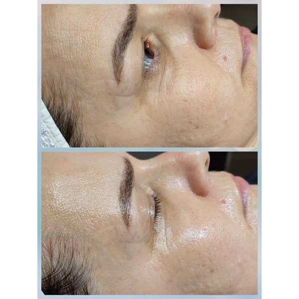 Merve Şensoy Güzellik Merkezi - 3. Fotoğraf Merve Şensoy Güzellik Merkezi - 3. Fotoğraf