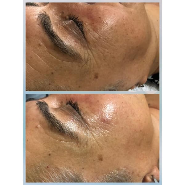 Merve Şensoy Güzellik Merkezi - 18. Fotoğraf Merve Şensoy Güzellik Merkezi - 18. Fotoğraf