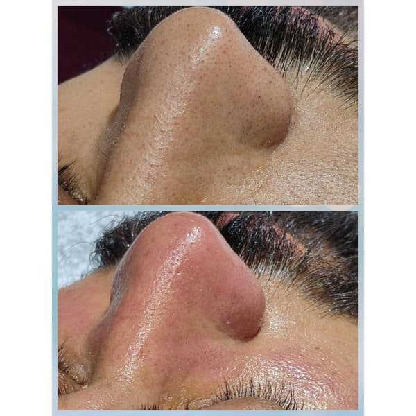 Merve Şensoy Güzellik Merkezi - 23. Fotoğraf Merve Şensoy Güzellik Merkezi - 23. Fotoğraf