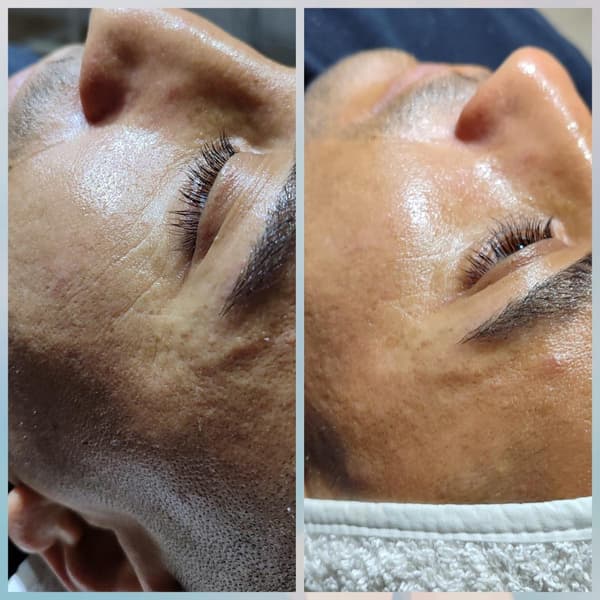 Merve Şensoy Güzellik Merkezi - 21. Fotoğraf Merve Şensoy Güzellik Merkezi - 21. Fotoğraf