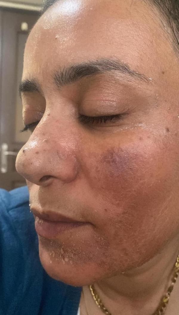 Sıla Yıldız Beauty - 5. Fotoğraf