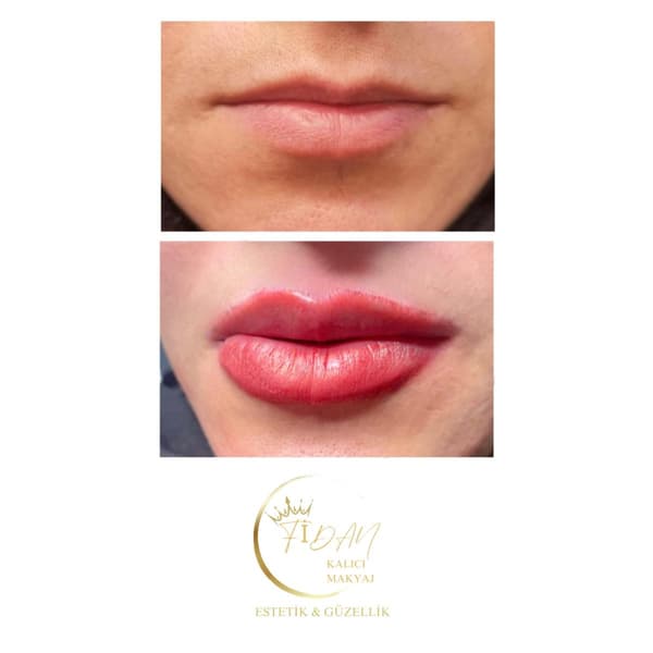 Fidan Kalıcı Makyaj Estetik Güzellik - 5. Fotoğraf Fidan Kalıcı Makyaj Estetik Güzellik - 5. Fotoğraf